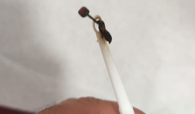 העגיל שחולץ ממעמקי האוזן