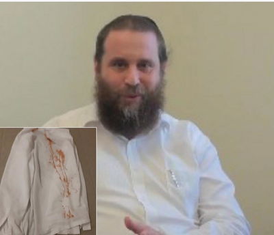 החולצה מלאה בכתמים