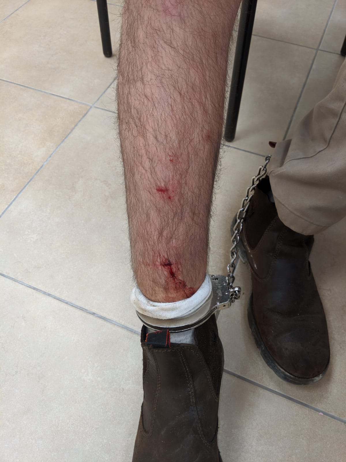 השוטרים תועדו פוצעים את נריה זארוג • צפו