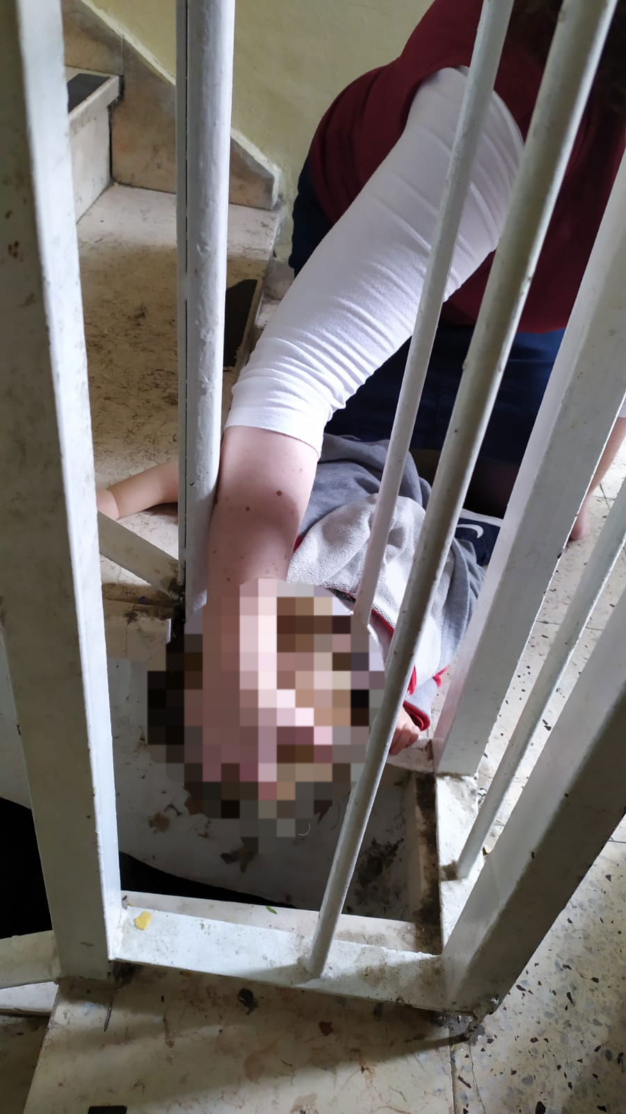 ראשו של ילד כבן שנה נלכד בין הסורגים - וחולץ