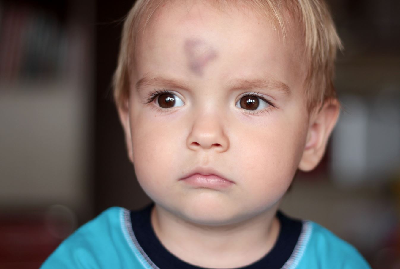 כל מכה קטנה גורמת לכם לסימן כחול? הנה הסיבות לכך