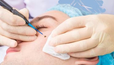 אילוסטרציה