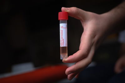 בדיקת 'קורונה'