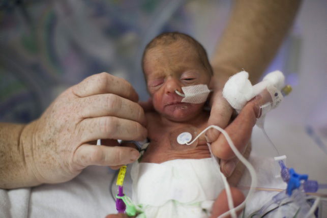 פג, אילוסטרציה