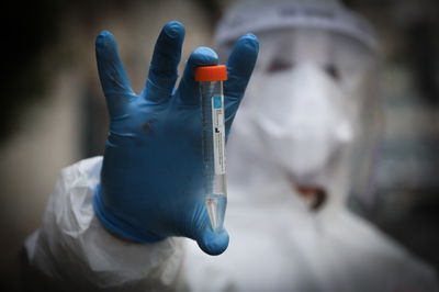 הלילה: ארבעה חולים נפטרו מנגיף הקורונה