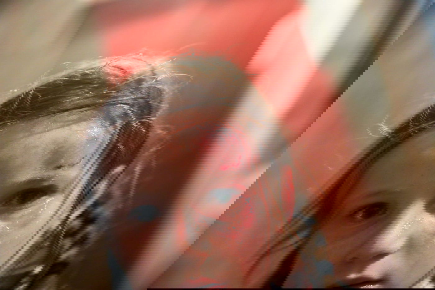 הילדה הפצועה.