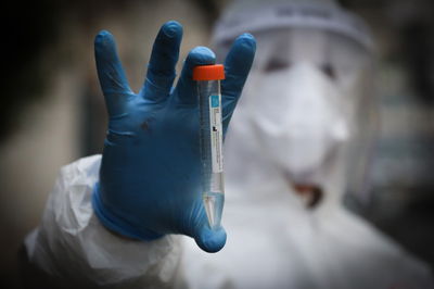 14,326 נדבקי 'קורונה' בישראל • 187 נפטרו, 111 מונשמים