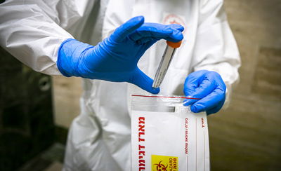 המכון למחקר ביולוגי: הגענו לפריצת הדרך במציאת הנוגדן