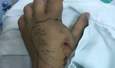 הכשת נחש. ארכיון