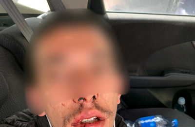 פקחים ערבים תקפו חרדי באלימות, ושוחררו