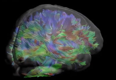 "פצצה מתקתקת": חשש לאירועים מוחיים בגלל הקורונה