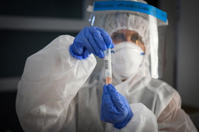 ביממה האחרונה: 621 מאובחנים חדשים; 4 נפטרו מקורונה