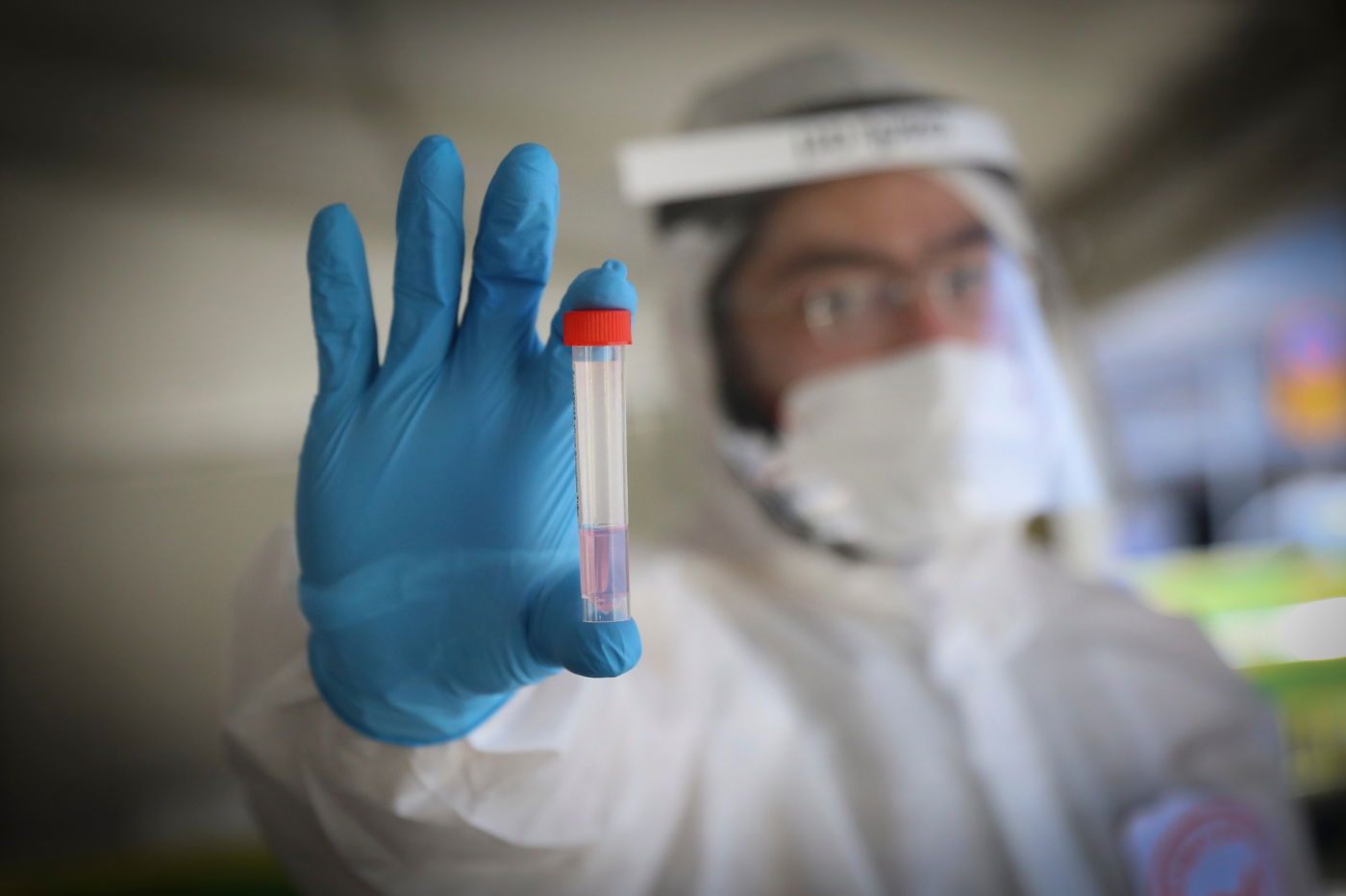 המגיפה מתפשטת: 11,189 חולים פעילים; 86 במצב קשה