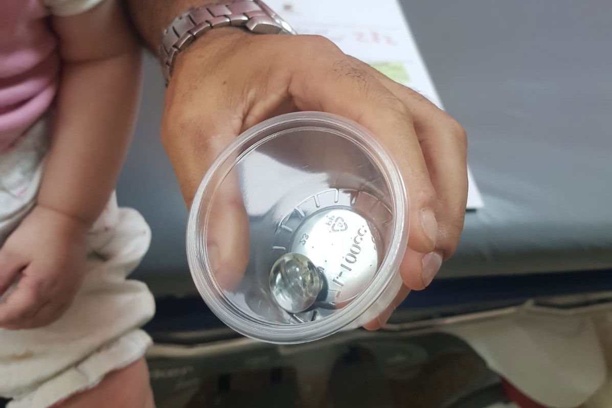 הגולה שחולצה