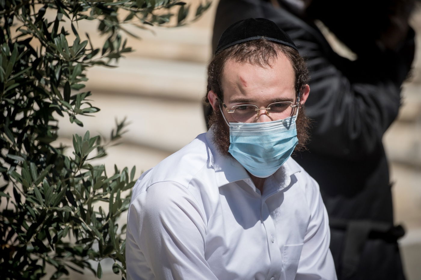 החרדי ששוטר הלם בראשו ונעצר - השתחרר • צפו