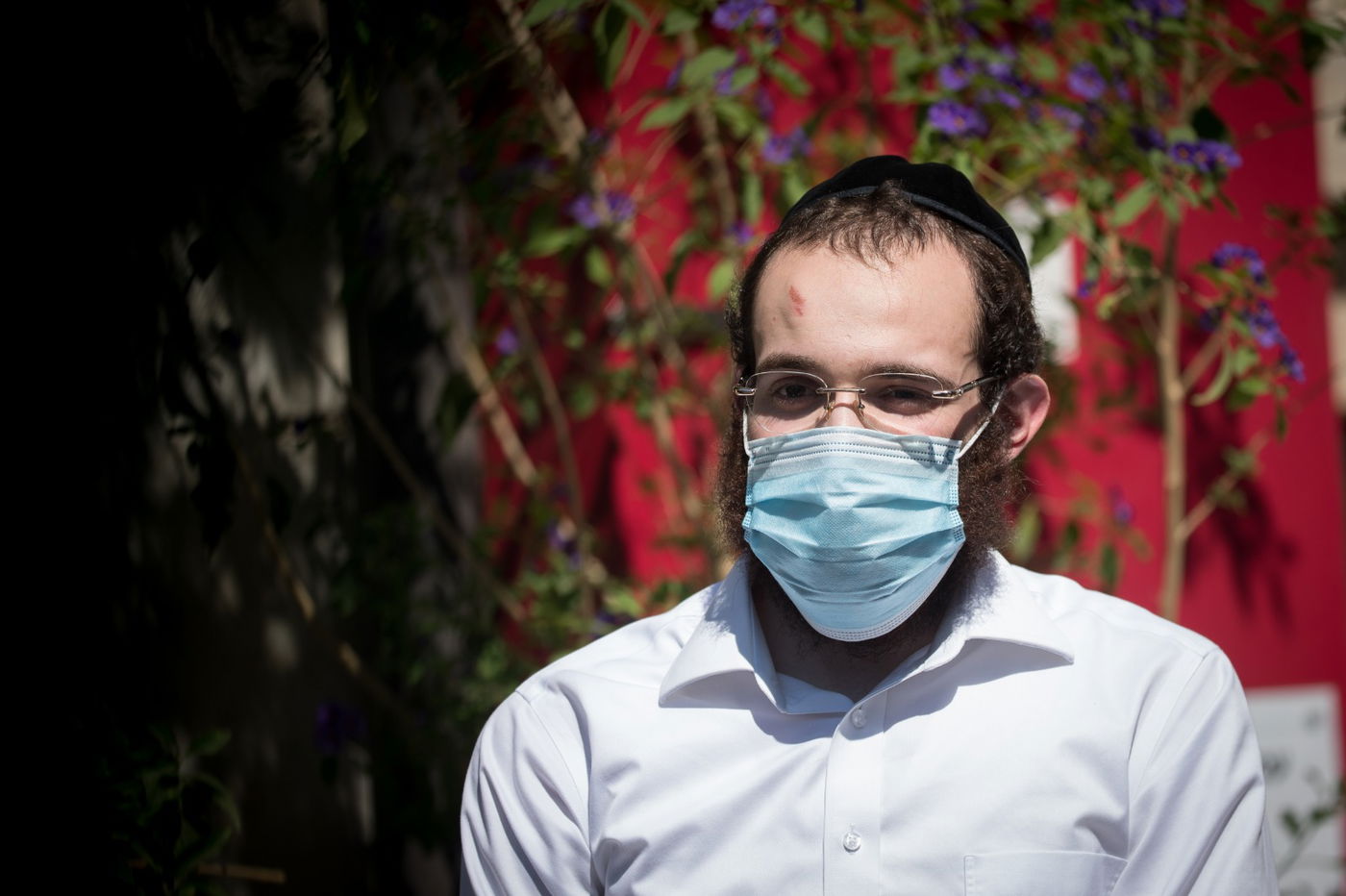 החרדי ששוטר הלם בראשו ונעצר - השתחרר • צפו