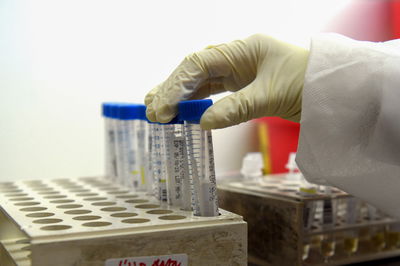 תמונת מצב עגומה: 22,324 חולים פעילים