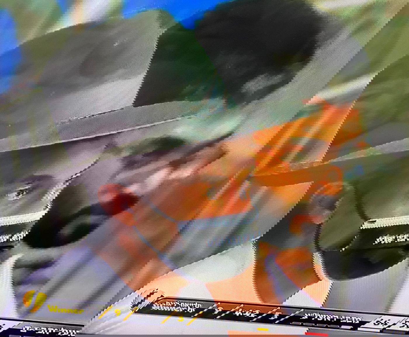 כוכב הכדורסל הופיע למשחק עם לוק חרדי