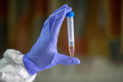 הסקר הפנימי של 'דגל התורה' על הטיפול ב'קורונה'