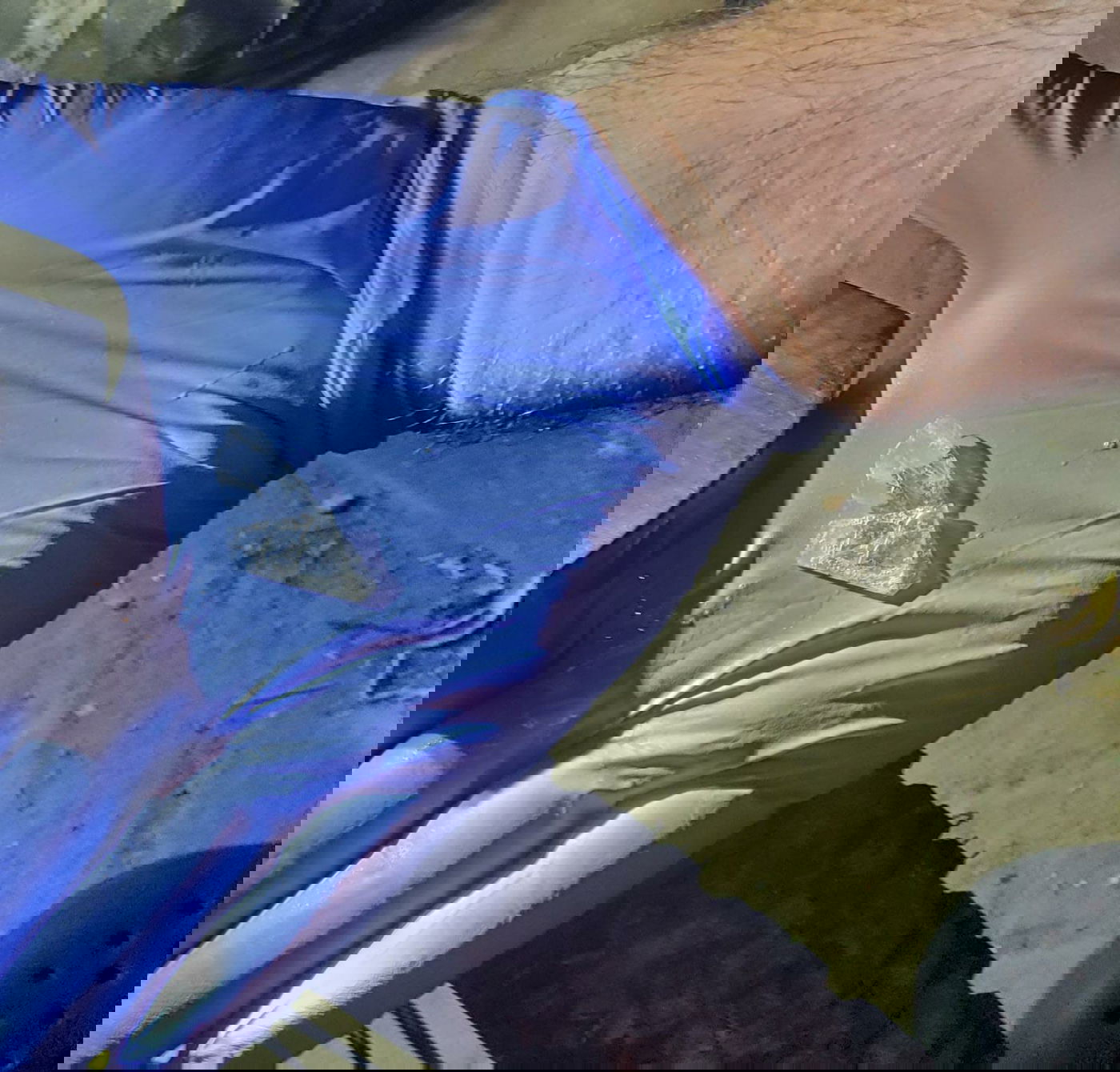 פעוטה בת  7 חודשים נחנקה מדבק סלוטייפ