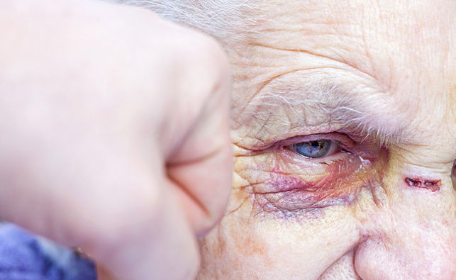 אילוסטרציה