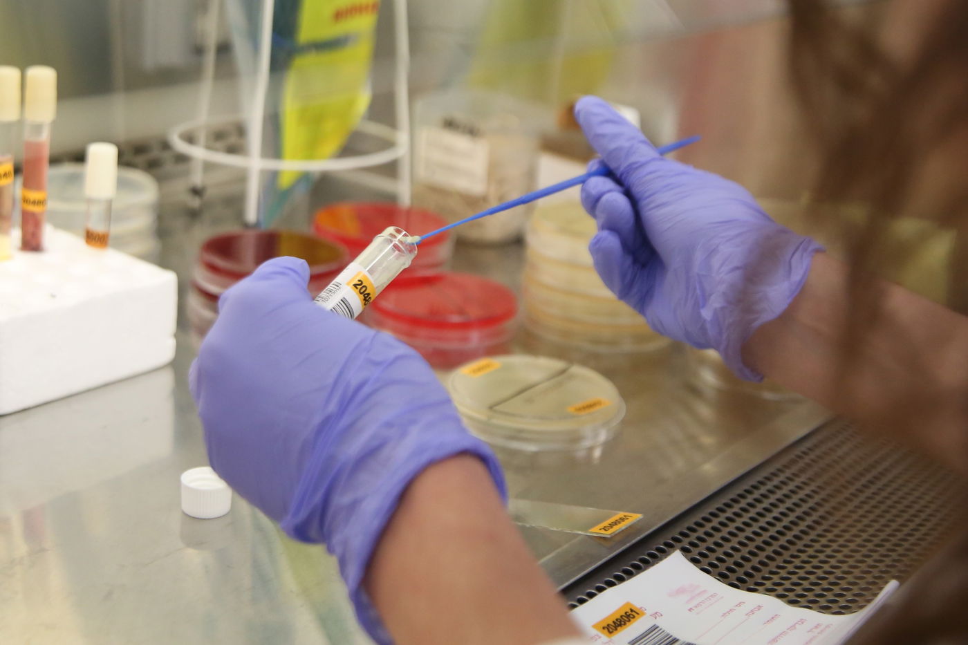 בדיקת קורונה