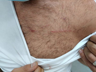 השוטר שנפצע