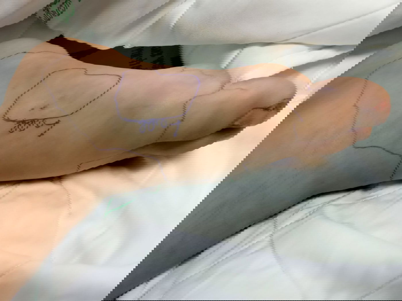 חייו של בן 10 ניצלו  בלניאדו מהכשת נחש צפע