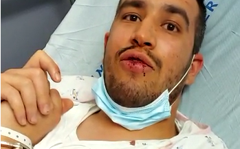 המשטרה חזרה בה: אח החתן שנעצר ישוחרר למעצר בית