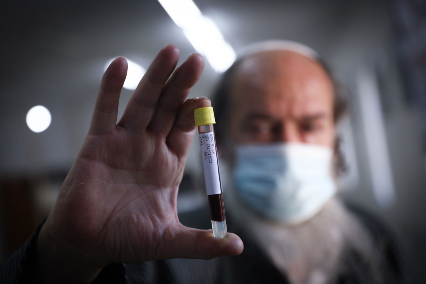 תיעוד: תלמידי הישיבות שהחלימו מקורונה תרמו את דמם כפלאזמות לחולים