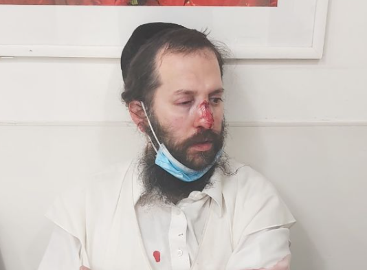 המותקף בגור: "מסיתים כדי להתיר את דמי"