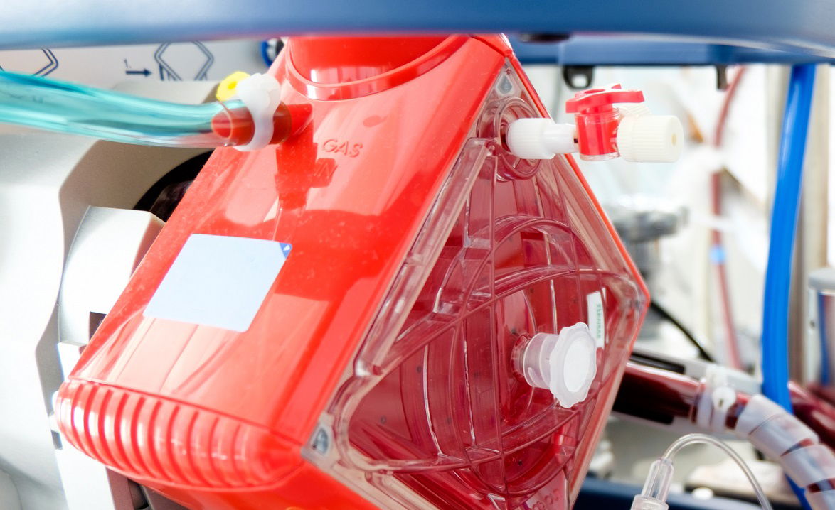 הילד חובר ל'אקמו'. אילוסטרציה