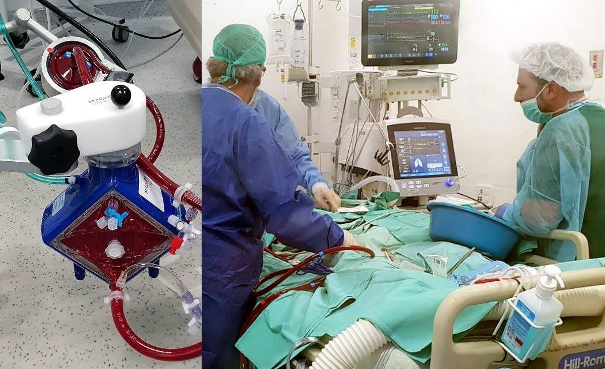 חיבור לאקמו. אילוסטרציה