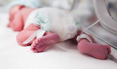 אילוסטרציה