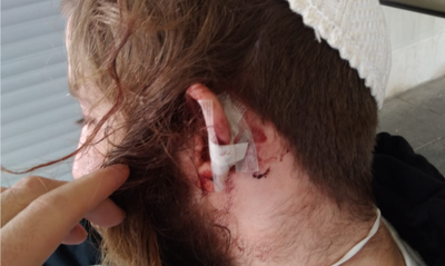 אחד הפצועים