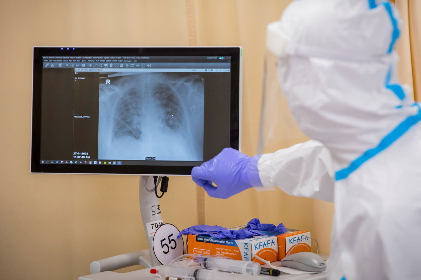 מחלקת קורונה בשערי צדק. ארכיון