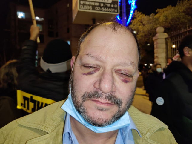 שוטרים נחקרו בחשד לתקיפת חבר הכנסת עופר כסיף