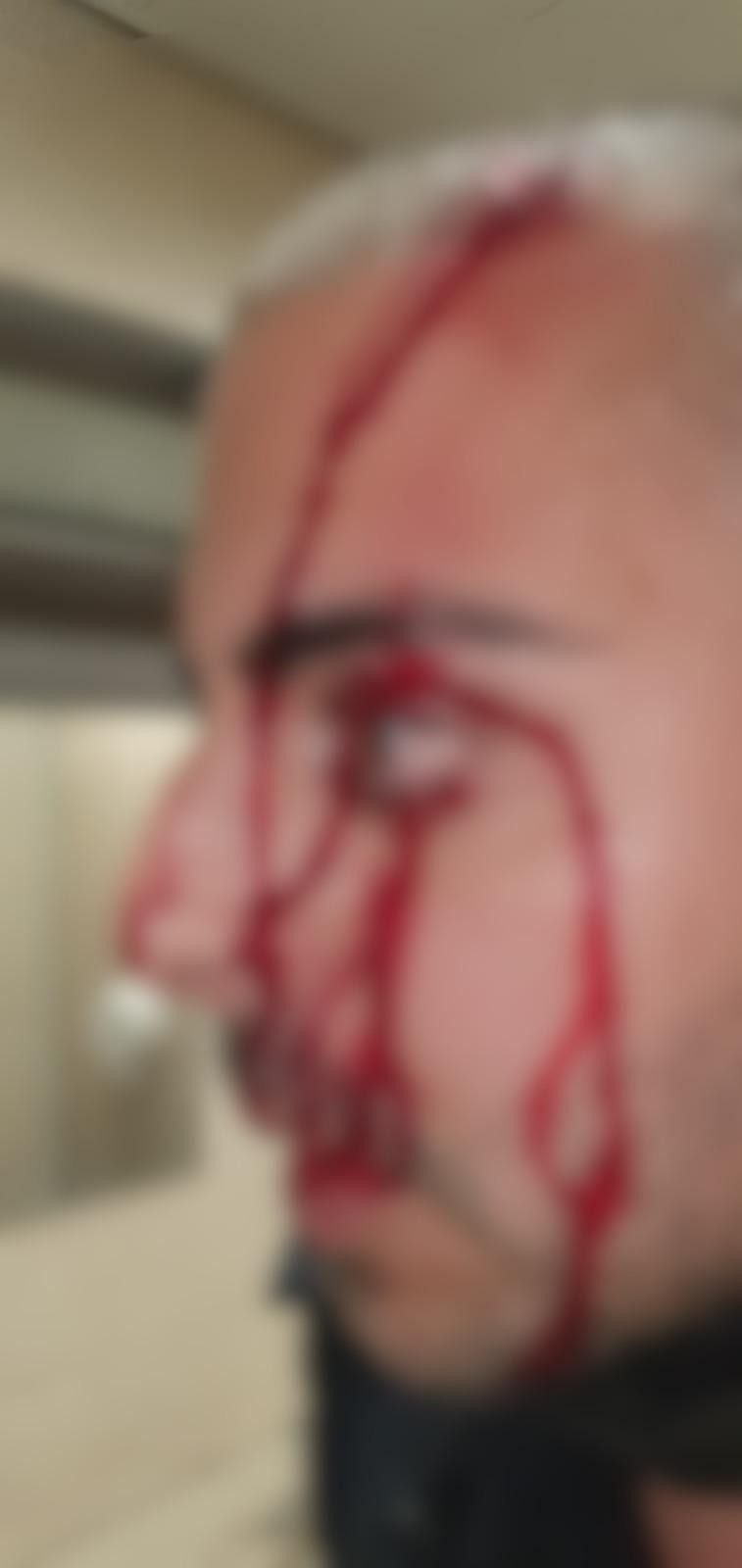 שוטר שנפצע בראשו