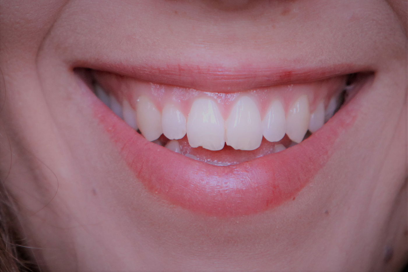 אילוסטרציה