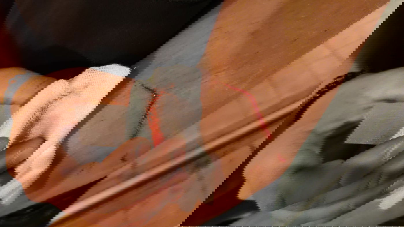 אחד הפצועים בקטטות