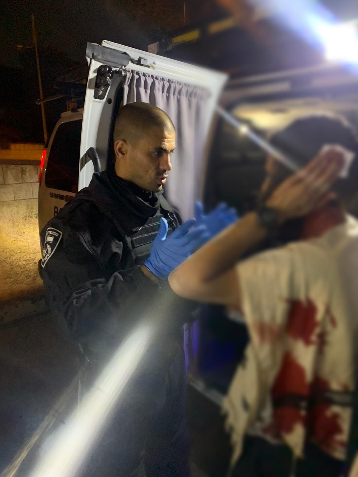 הנהג שנפצע בראשו מקבל טיפול