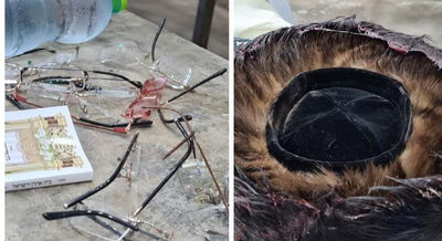 שטריימל מגואל בדם • תיעוד קשה מהזירה