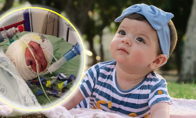 רות ויקטוריה, לפני ואחרי הכוויות