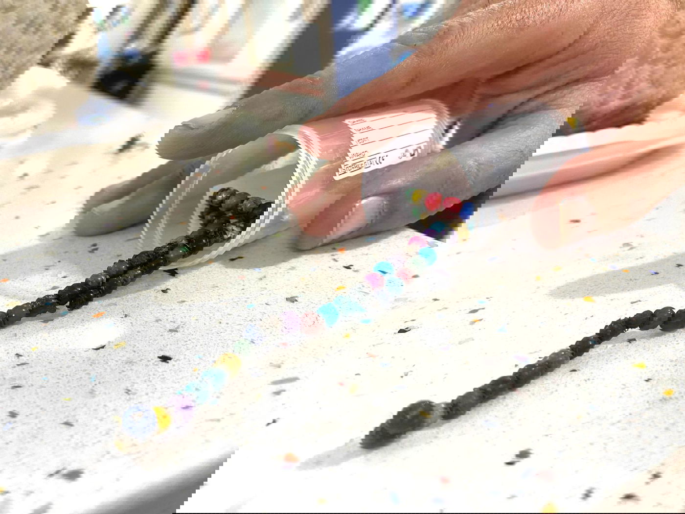 תינוק בלע 52 חרוזי מגנט שהוצאו בניתוח