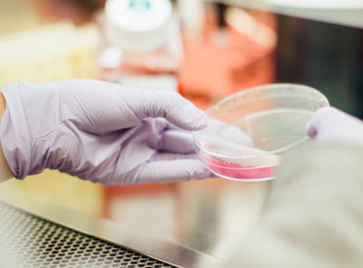 חיידק שגורם לאנשים להרזות - הסוף לדיאטות?