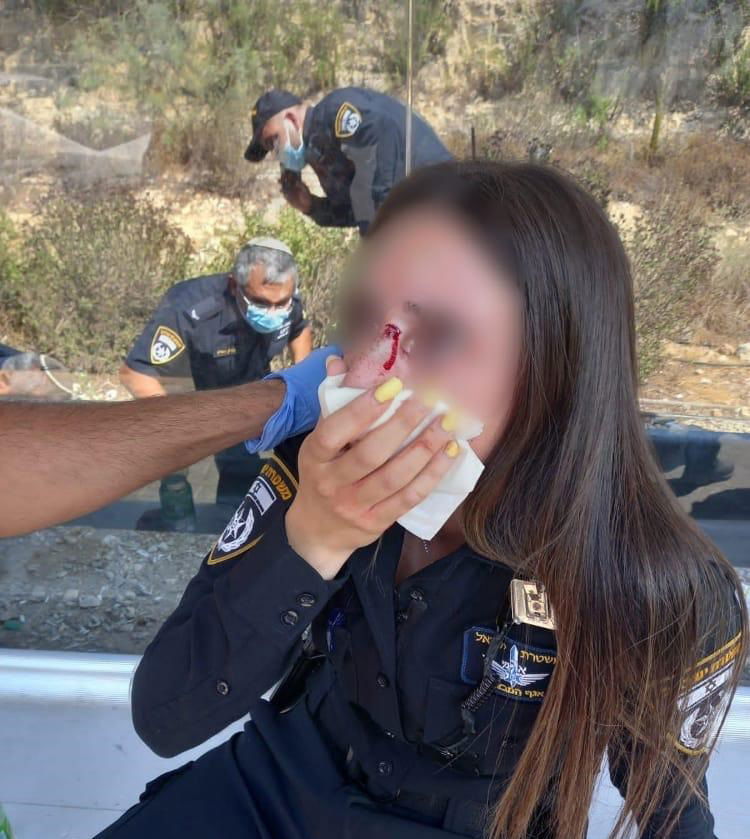 אדם שלא עטה מסכה, תקף באלימות שוטרות שביקשו ממנו להזדהות