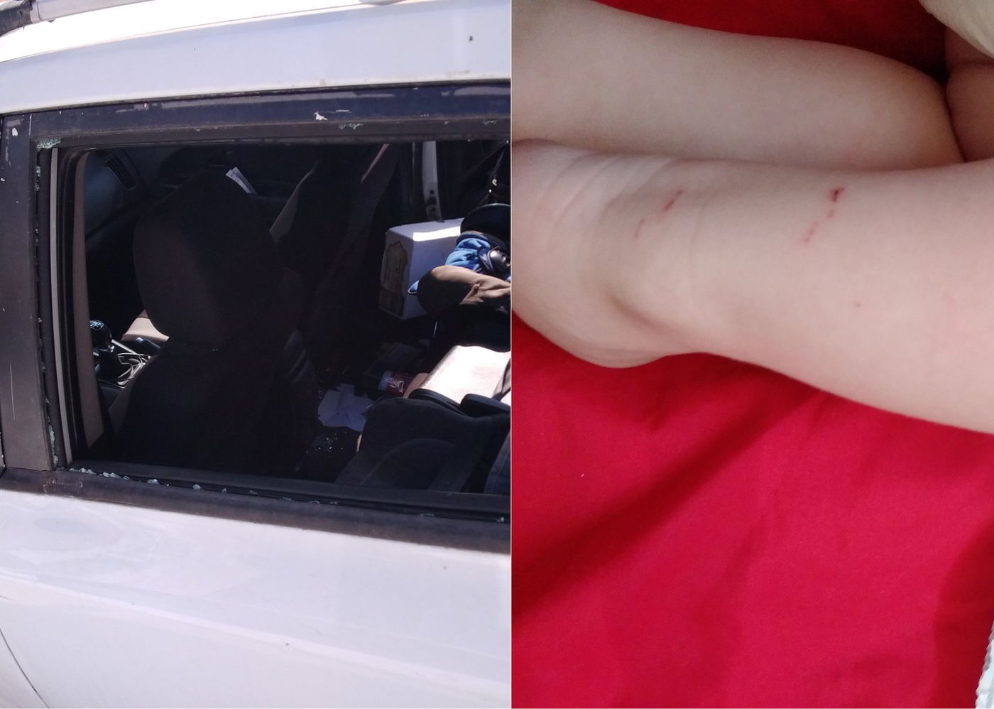 משפחה חרדית הותקפה; תינוק נשרט בידו מזכוכיות