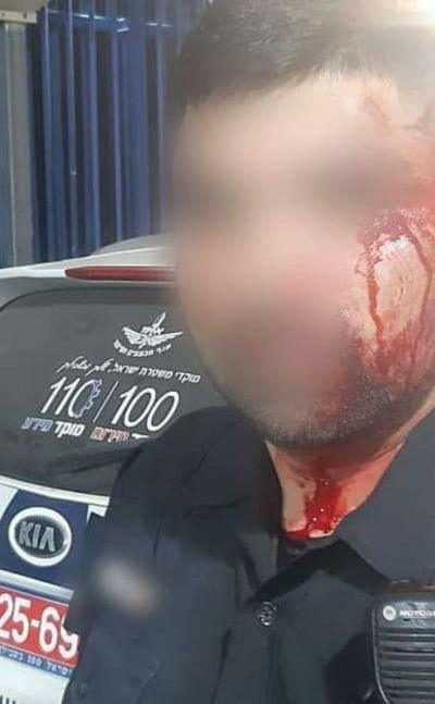 השוטר שהוכה בכפר קאסם