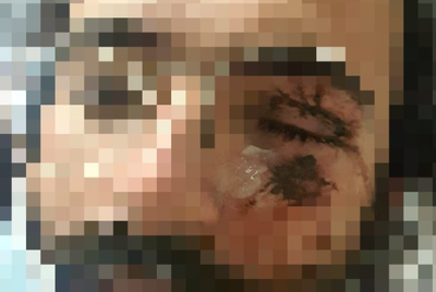 אחד האחים שהוכה