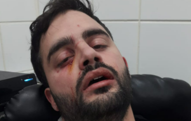 משגיח הכשרות שהותקף אמש